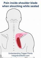 Trigger Point Therapy Shoulder Images