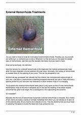 Medication For Internal Hemorrhoids Photos