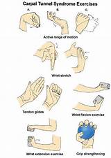 Images of What Doctor Do I See For Carpal Tunnel Syndrome