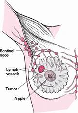 Pictures of What Is A Lymph Node Doctor Called