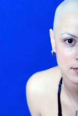 Integrative Cancer Treatment Pictures