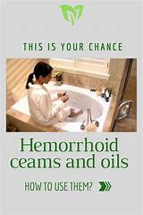 Pictures of How Do Doctors Remove Hemorrhoids