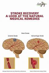 Natural Remedies For Stroke Recovery Images