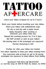 Tattoo Removal Care Credit Pictures