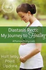 Diastasis Recti Rehabilitation Photos