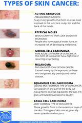 Benign Skin Cancer Treatment Pictures