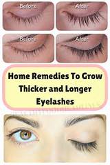 Photos of Thicker Lashes Home Remedies