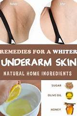 Home Remedies For Darker Skin Images