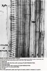 Where Can Xylem Be Found Pictures