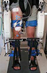 Electric Stimulation Therapy Side Effects Images