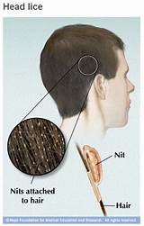 Head Lice Doctor Photos
