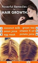 Photos of Hair Growth With Home Remedies