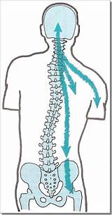 Pictures of Neck Vertebrae Out Of Alignment Treatment