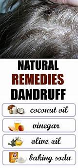 Home Remedies Against Dandruff Photos