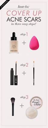 Makeup To Cover Age Spots Pictures