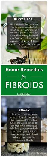 Fibroids And Gas