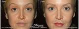 Artistry Of Permanent Makeup Images