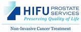 Hifu Prostate Services Images