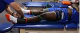 What Is Blood Flow Restriction Therapy Pictures