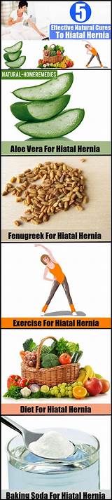 Hiatal Hernia Treatment Home Remedy Pictures