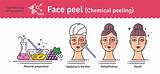 Chemical Peel Maryland Pictures