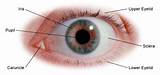 Images of Pros And Cons Of Lasik Eye Surgery 2012