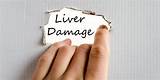 Liver Doctor Hepatologist Images
