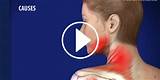 Myofascial Pain Syndrome Treatment