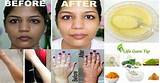 Photos of Whitening Mask Home Remedies