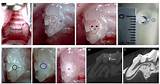 Images of Stem Cell Teeth Clinical Trials