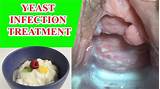 Best Yeast Infection Treatment Walgreens Images