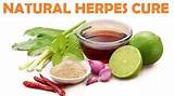 Herpes Home Remedies Cure Images