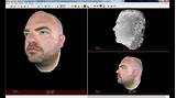 Pictures of Facial Reconstruction Software