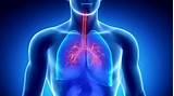 Emphysema Treatment Breakthrough