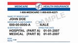 Medicare Part B Dental Insurance