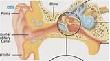 Labyrinthitis Balance Exercises Photos