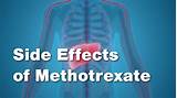 Photos of What Are The Most Common Side Effects Of Methotre Ate