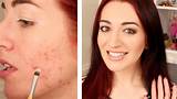 Photos of How To Cover Up Acne With Makeup