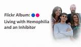Hemophilia Treatment Centers Directory Images