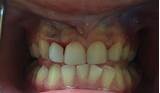 Fremont Dental Excellence Images