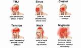 Pictures of Bad Migraine Treatment
