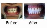 Dental Clinic Philippines Prices Pictures