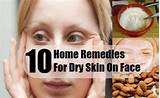 Winter Home Remedies For Dry Skin Pictures