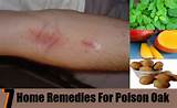 Images of Treat Poison Oak Home Remedies