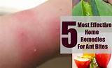 Photos of Ant Treatment Home Remedies