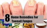 Images of Webmd Home Remedies