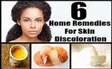 Images of Firm Skin Home Remedies