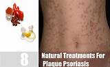 Photos of Plaque Psoriasis Treatment Drugs