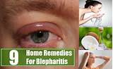 Eye Diseases Home Remedies Photos