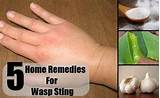 Wasp Bite Home Remedies